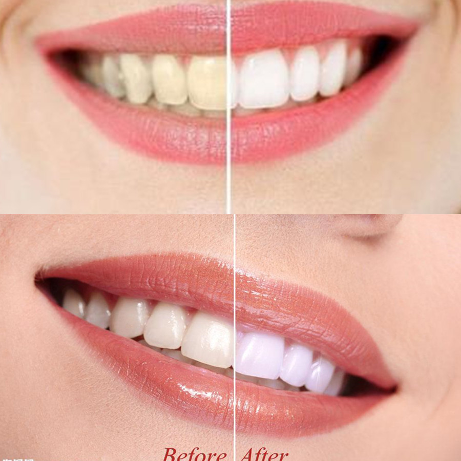 Bamboo Charcoal Teeth Tooth De - огляд і ціна Teeth Whitening Lab