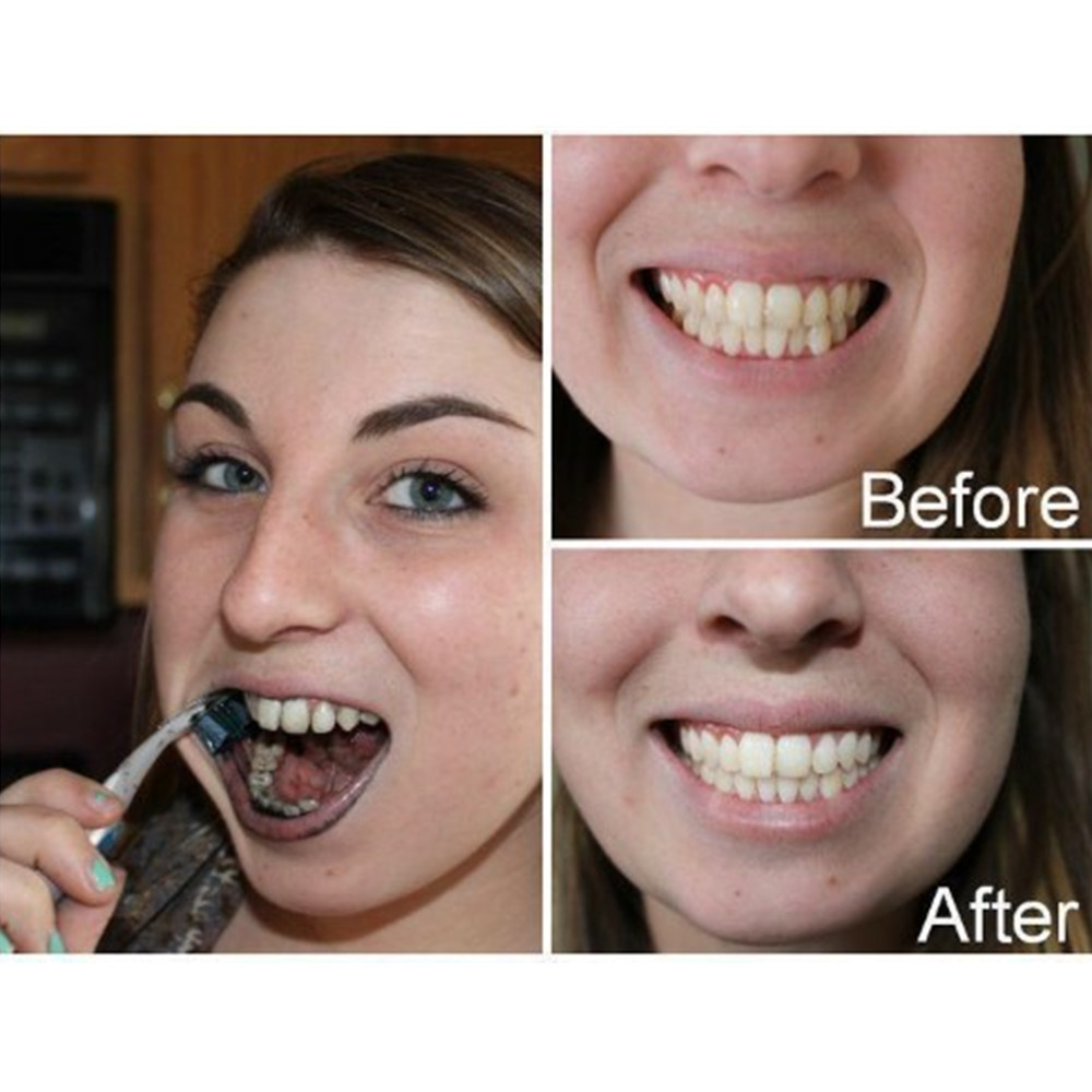 Bamboo Charcoal Teeth Tooth De - огляд і ціна Teeth Whitening Lab