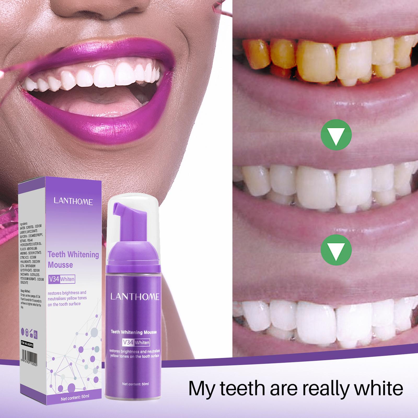 50MLTeeth Whitening Mousse Rem - огляд і ціна Teeth Whitening Foam Toothpaste