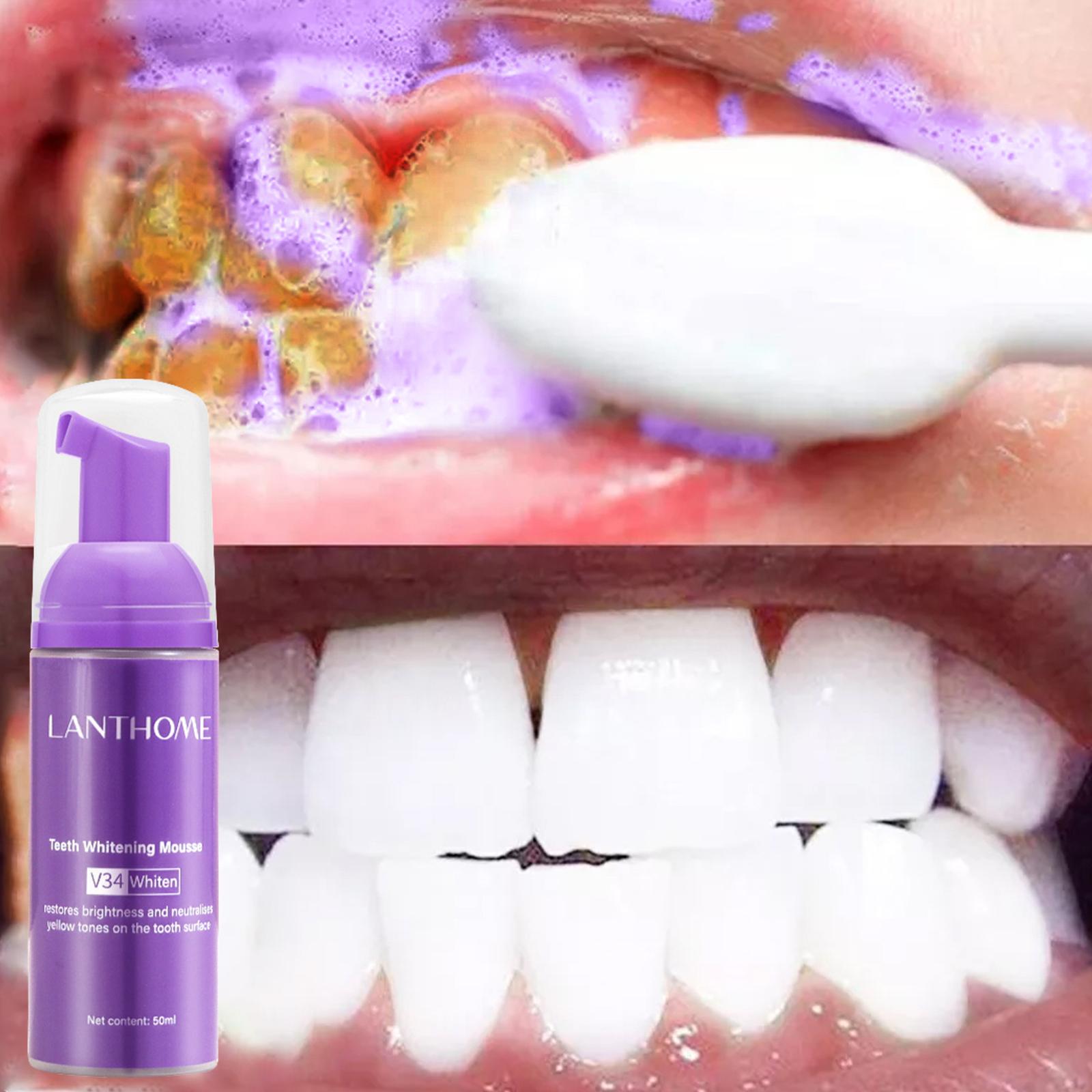 50MLTeeth Whitening Mousse Rem - огляд і ціна Teeth Whitening Foam Toothpaste