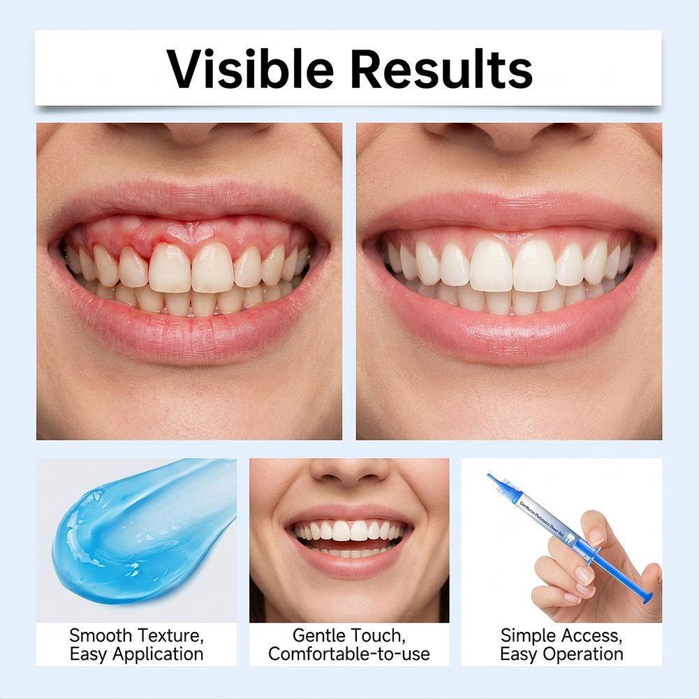 3Pcs Gum Repair Gel Hydroxyapa - огляд і ціна Teeth Whitening Products