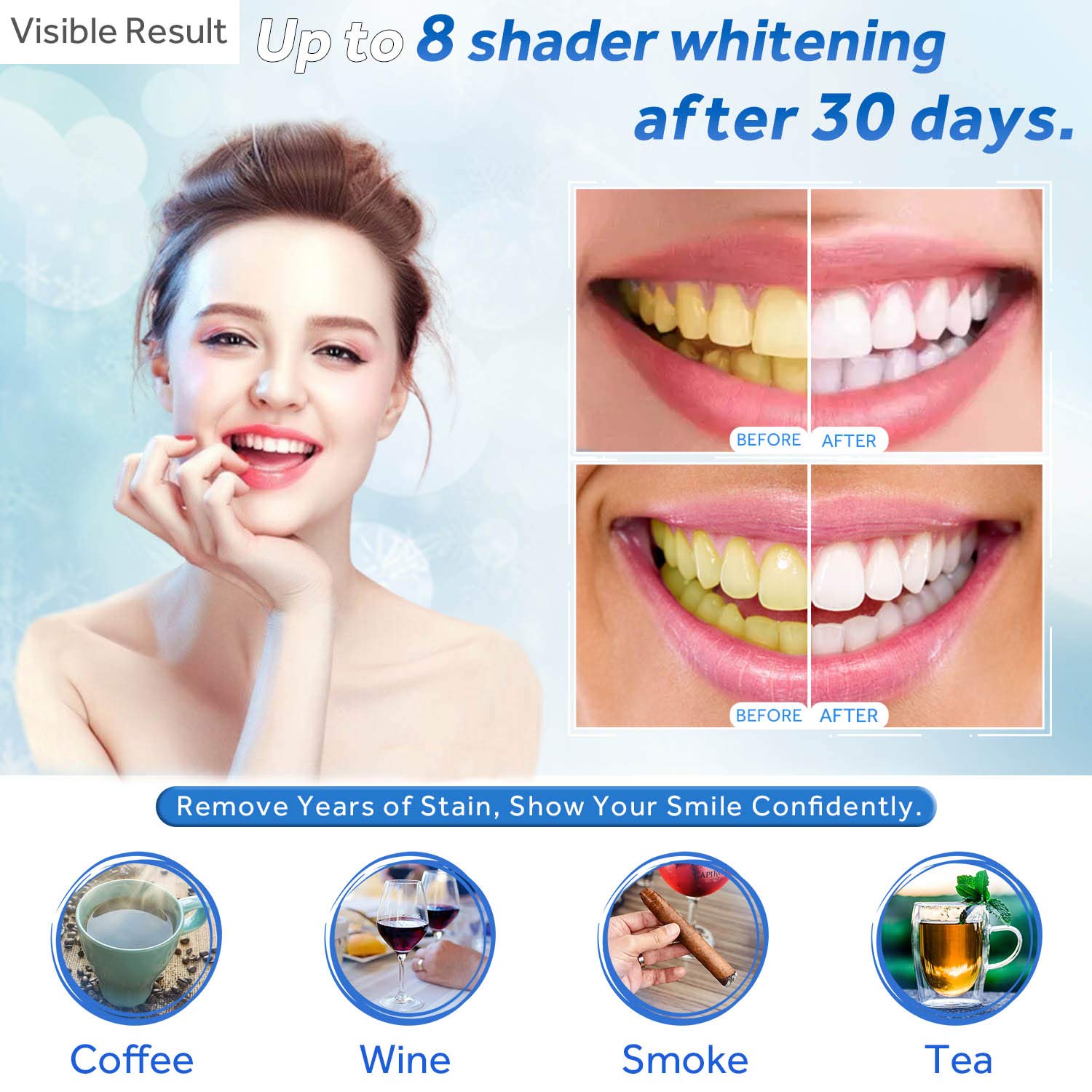 Teeth Whitening Gel Refill Syr - огляд і ціна Teeth Whitening Gel Refills