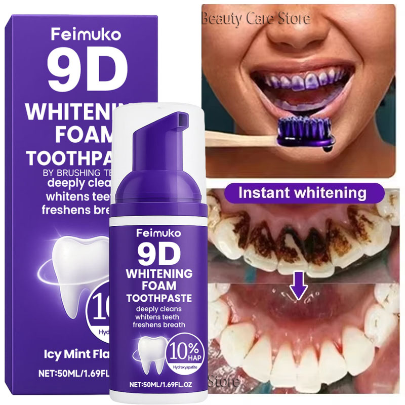 9D Purple Teeth Whitening Toot - огляд і ціна Teeth Whitening Yellow Teeth