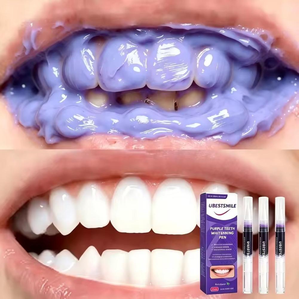 Purple Teeth Whitening Pen V34 - огляд і ціна Teeth Whitening Pens