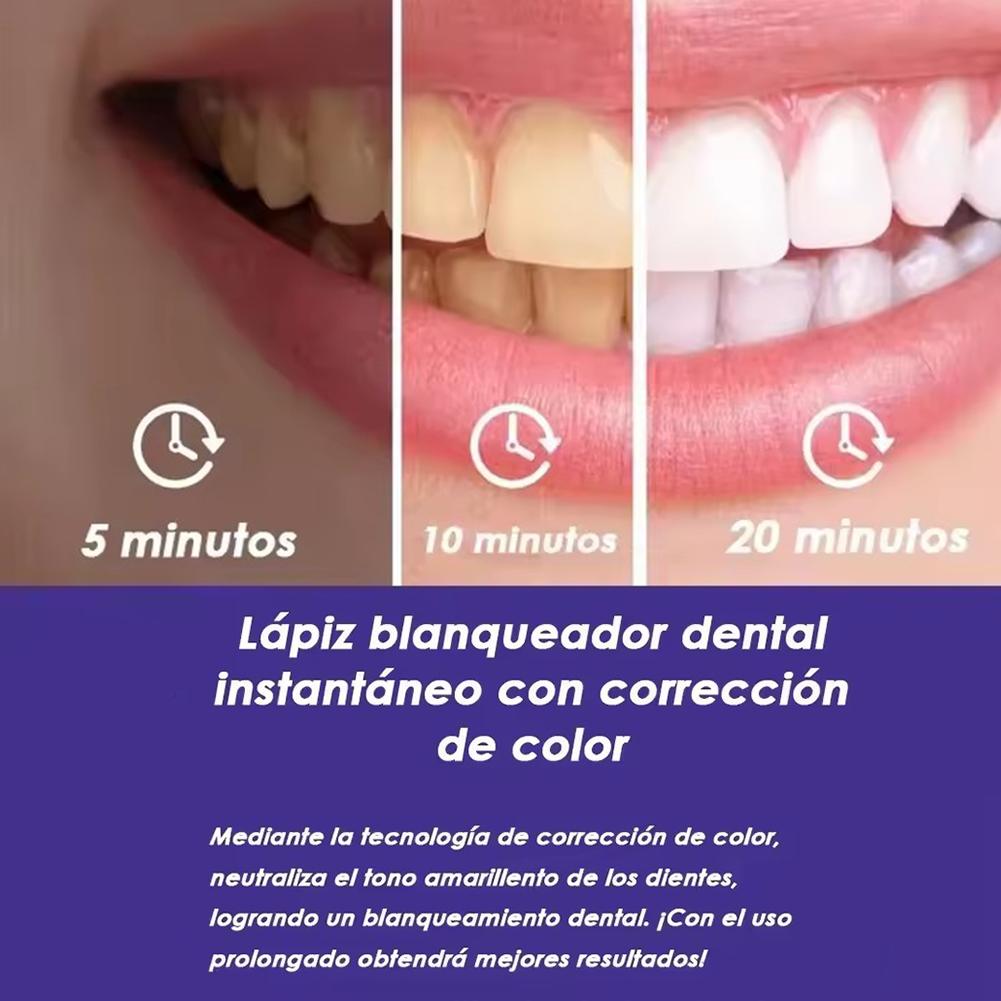 Purple Teeth Whitening Pen V34 - огляд і ціна Teeth Whitening Pens