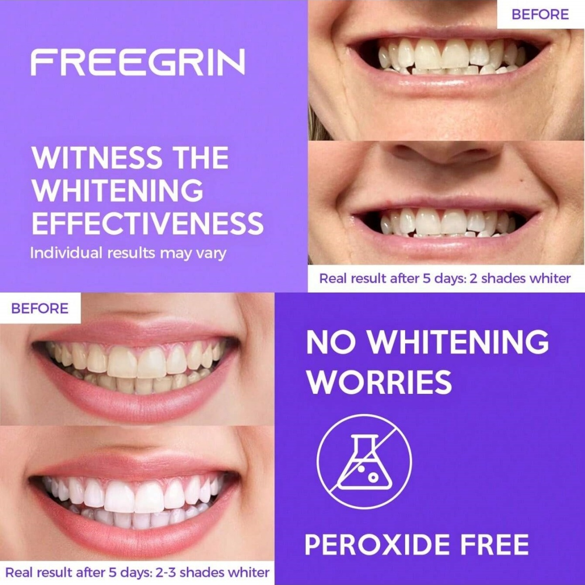 Deluxe Whitening Teeth Sticker - огляд і ціна Teeth Whitening Gel Refills