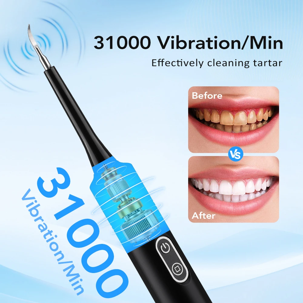 Electric Sonic Vibration Denta - огляд і ціна Teeth Whitening Products